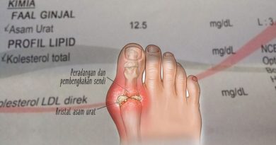 Yuk Kenali Penyakit Asam Urat Yuk Kenali Penyakit Asam Urat